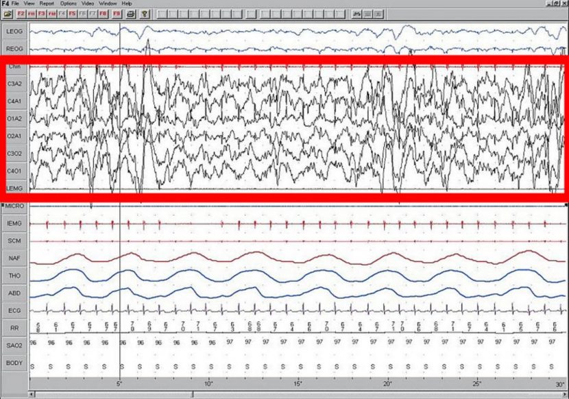 This is what brainwaves look like on an EEG.