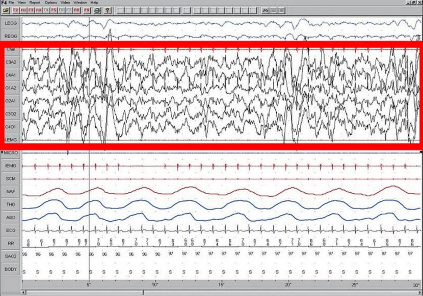 How To Use Brainwave Entrainment To Reach Your Goals